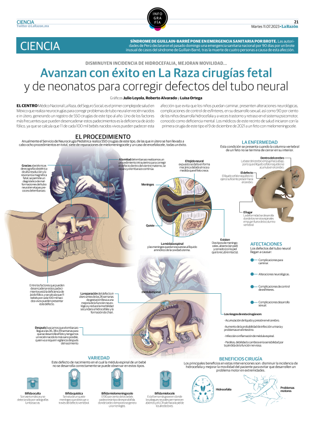 Cirugías fetal y de neonatos