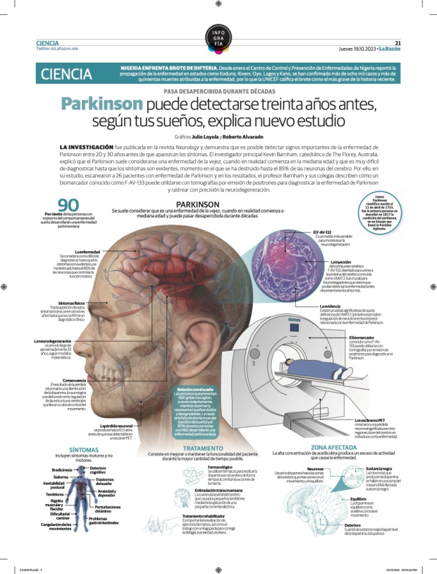Parkinson puede detectarse treinta años antes, según tus sueños, explica nuevo estudio