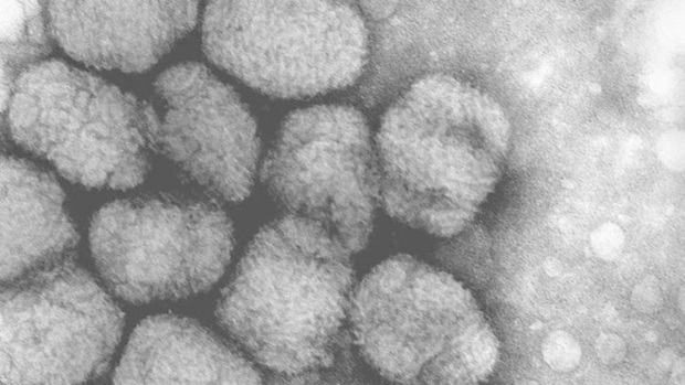 El virus de Alaskapox nunca había registrado una muerte desde que fue descubierto en el 2015.