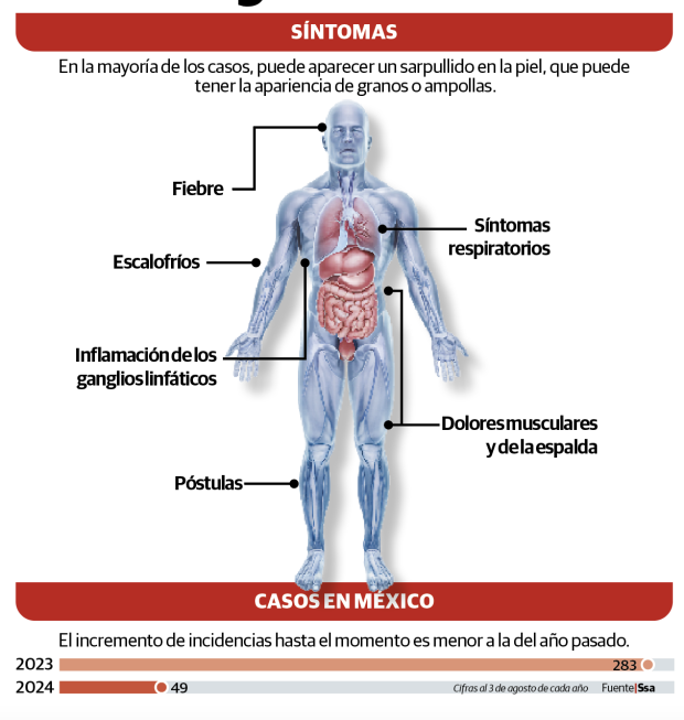 Gráfico