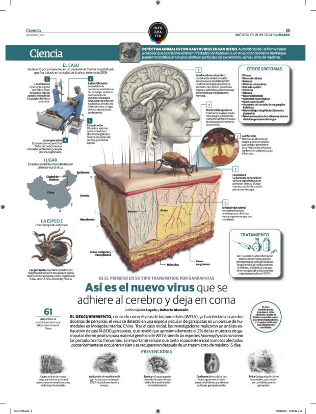 Virus que se adhiere al cerebro