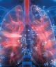 Aumenta 42% la incidencia de enfermedades respiratorias