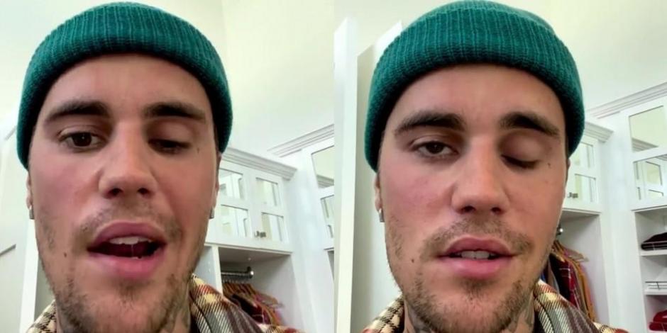 Justin Bieber muestra su parálisis facial ¿Qué le pasó?