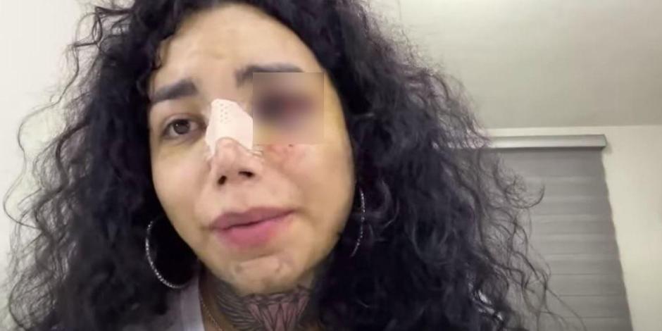 Un fan se tatúa cara golpeada de Paola Suárez de Las Perdidas