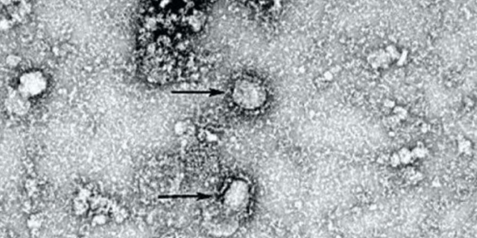 Así se ve el coronavirus chino, que ha cobrado la vida de 41 personas (FOTO)