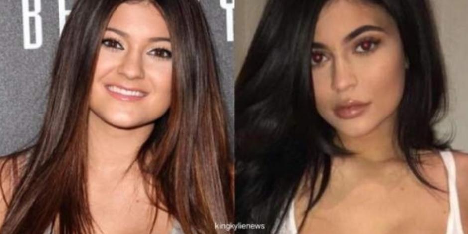 Así fue la transformación de Kylie Jenner (FOTOS)