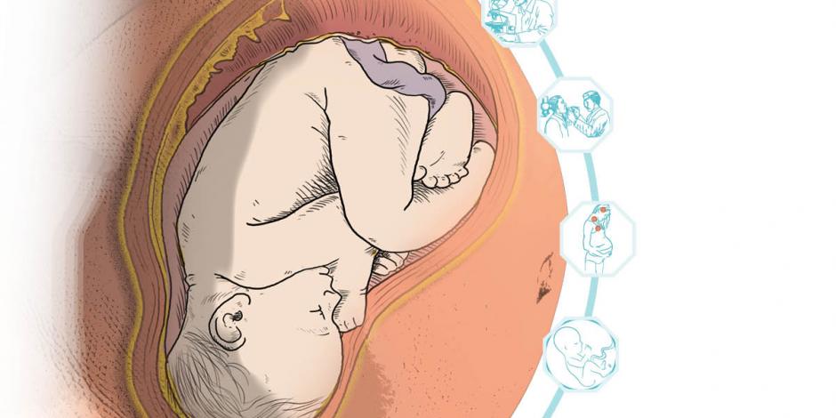Primeros estudios descartan contagio del Covid-19 de madre a hijo en gestación