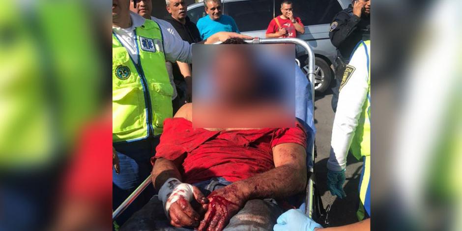"Si no te mato hoy, será otro día": hombre apuñala a su exesposa en Iztapalapa