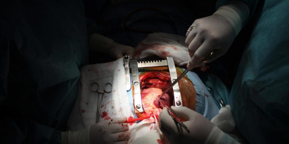 Corazón de paciente se incendia durante cirugía en hospital de Australia
