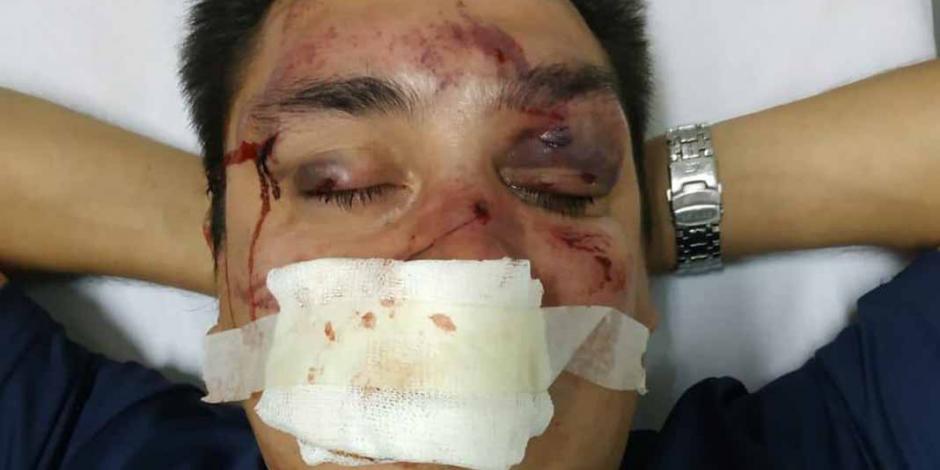 Periodista argentino es brutalmente golpeado por ser fan de Racing