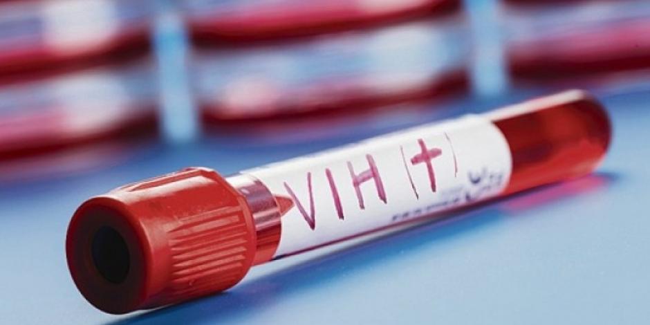 La mujer que no fue identificada es la segunda que se reporta que superó al VIH sin un tratamiento de médula