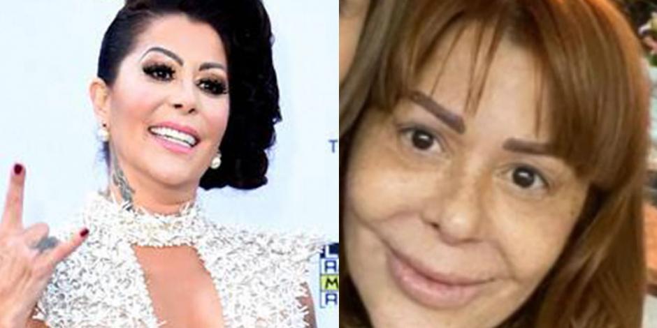 Alejandra Guzmán, así ha sido la transformación de su rostro (FOTOS)
