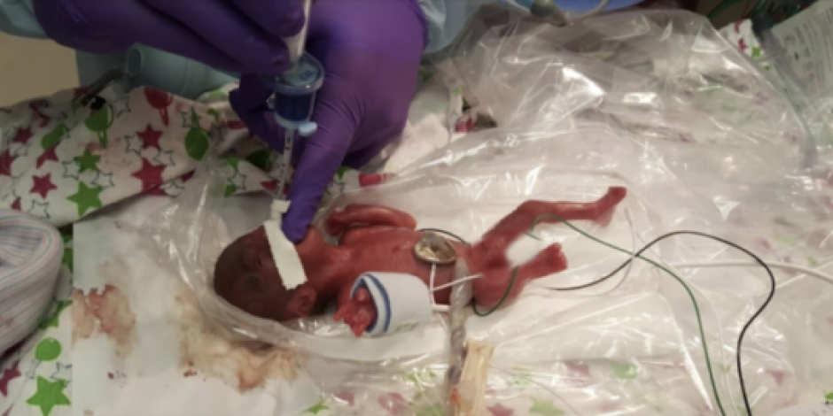 VIDEO: Bebé nace con peso de 245 gramos y logra sobrevivir