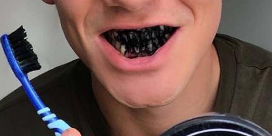 Lavarse los dientes con carbón: una peligrosa moda