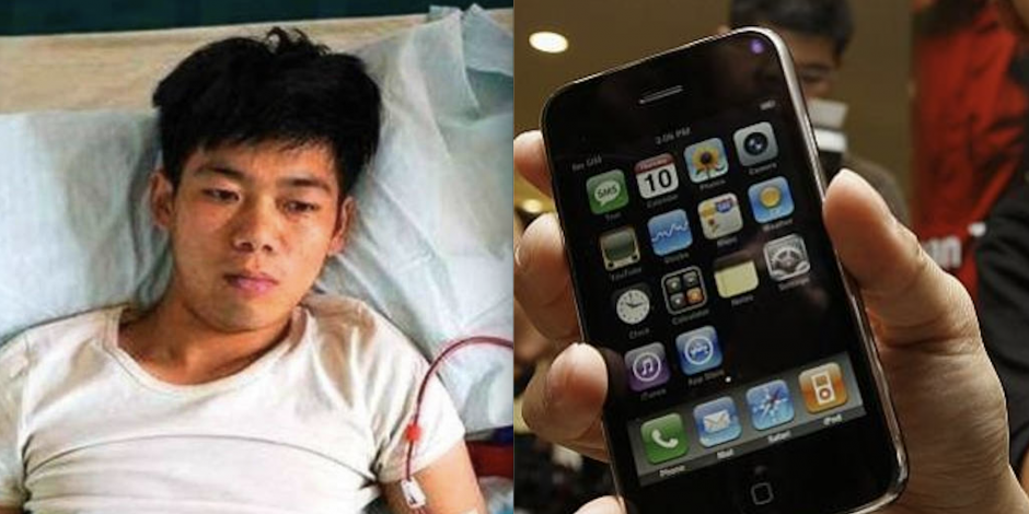 Vendió su riñón para comprar un Iphone; quedó con discapacidad