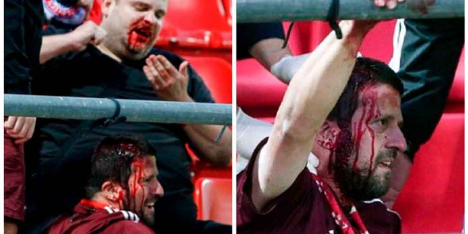 FOTOS: Aficionados del Bayern Münich reciben brutal golpiza en Grecia