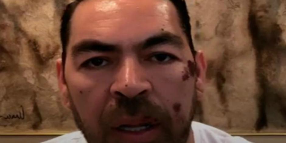 Jorge D'Alessio relata cómo fue drogado y asaltado en un taxi en la CDMX