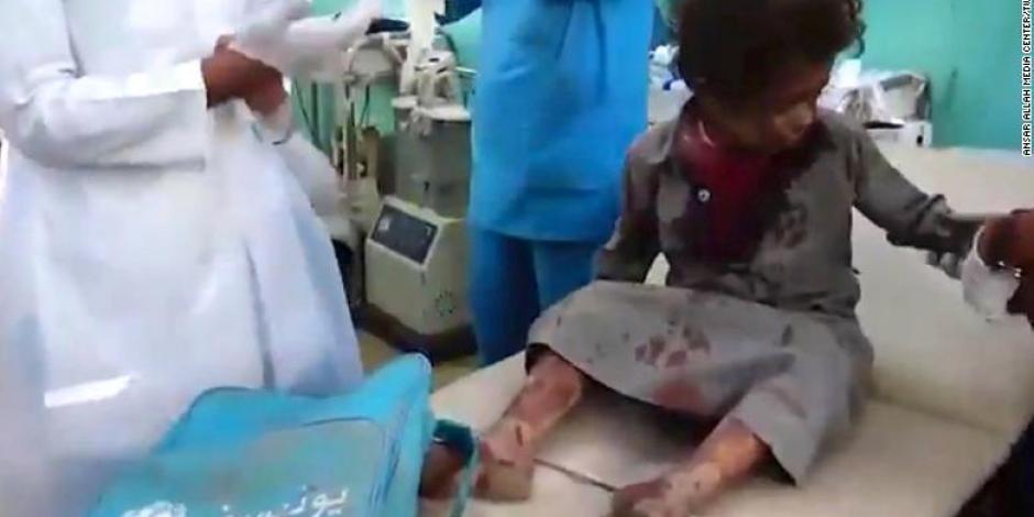 VIDEO: Ataque aéreo a autobús escolar deja 43 muertos en Yemen