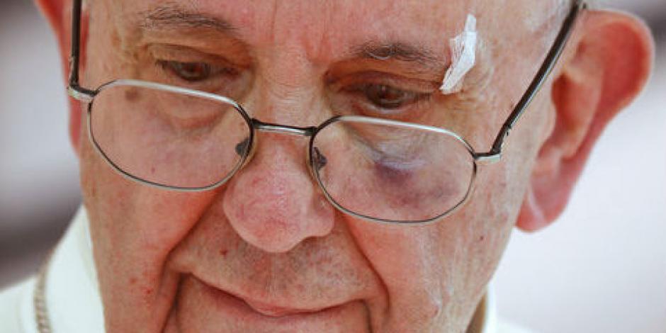 VIDEO: En Colombia, Papa Francisco sufre accidente vehicular