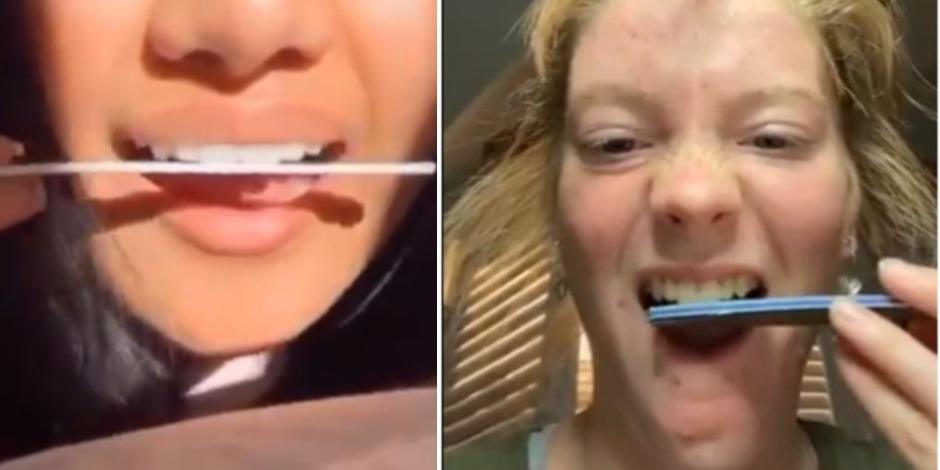 Reto viral de limarse los dientes para "emparejarlos"