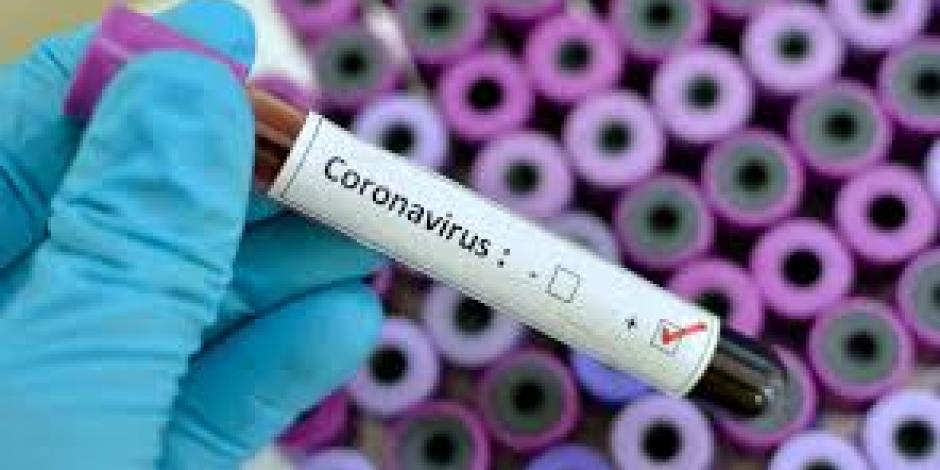 Análisis clínicos para encontrar la vacuna contra el coronavirus.