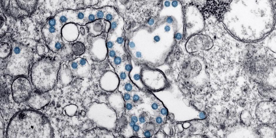 Partículas del virus SARS-CoV-2, coloreadas en azul, en una imagen de microscopio de electrones.