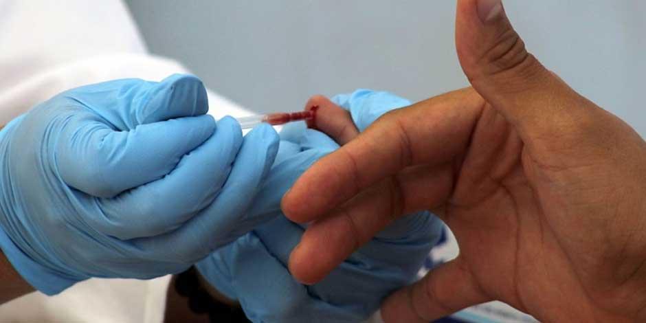 México participa en ensayo contra el VIH