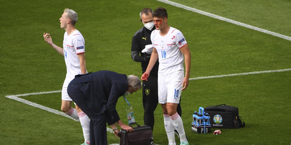 Patrik Schick momentos después de que un defensa croata le rompiera la nariz en duelo de la Eurocopa 2021.
