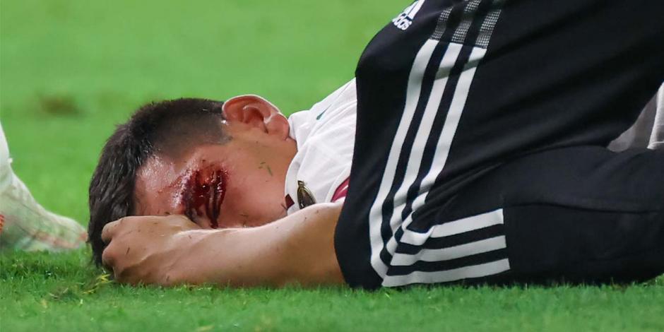 "Chucky" Lozano sufre una escalofriante lesión en la Copa Oro.
