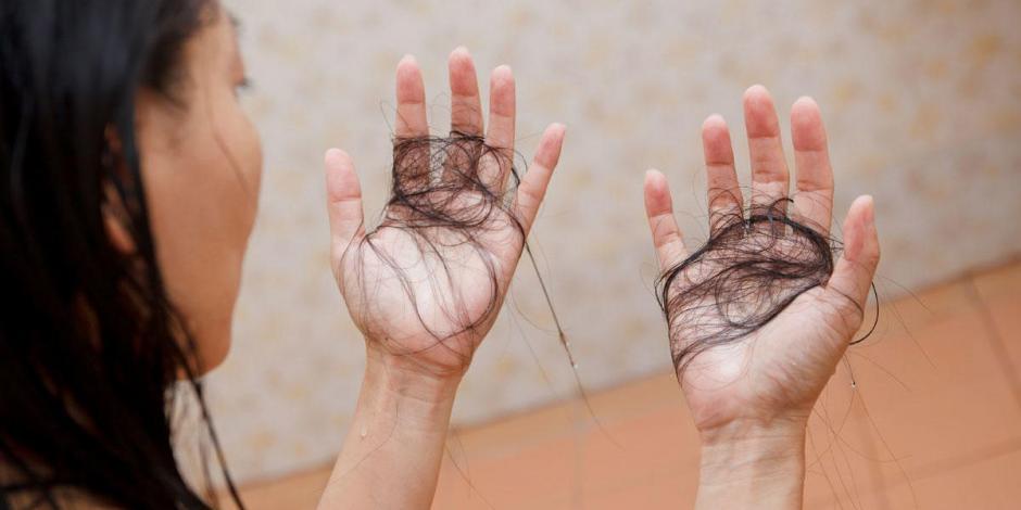 La caída del cabello es una secuela de padecer COVID-19 en muchos casos