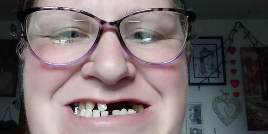 La mujer se retiró los dientes ella sola pues no puede pagar un tratamiento