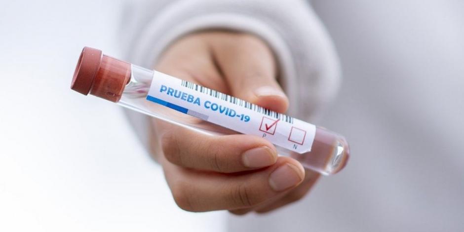 El kit viene con una prueba de antígenos para confirmar el contagio por COVID-19 (foto alusiva).