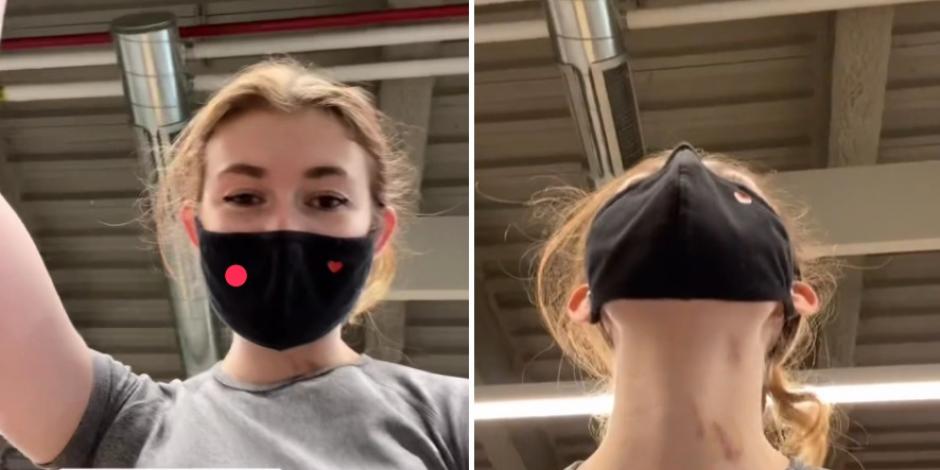 Mujer se pinta "chupetones" falsos en el cuello y la dejan de molestar en el gimnasio