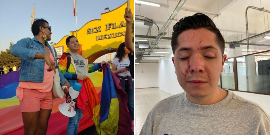 El usuario identificado como Rodrigo Arce compartió una fotografía suya durante la protesta en Six Flagas y una posterior tras las agresiones que denunció haber sufrido.