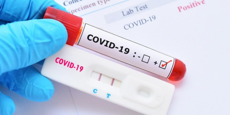 Si presentas síntomas evita salir a hacerte una prueba COVID.