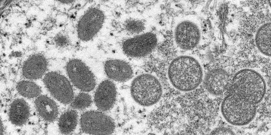 Partículas de viruela del mono bajo un microscopio; Japón detectó el primer caso de la enfermedad este lunes en un hombre.