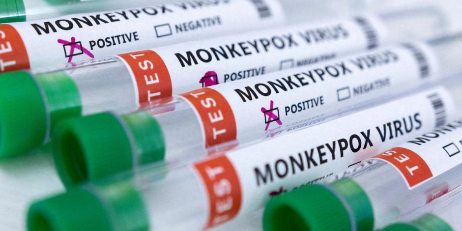 Casos confirmados de viruela del mono suben 72 por ciento en una semana.