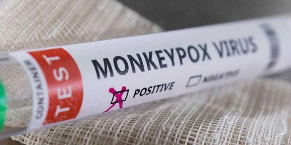 Viruela del mono: Confirman alrededor de mil 700 personas contagiadas en Francia.