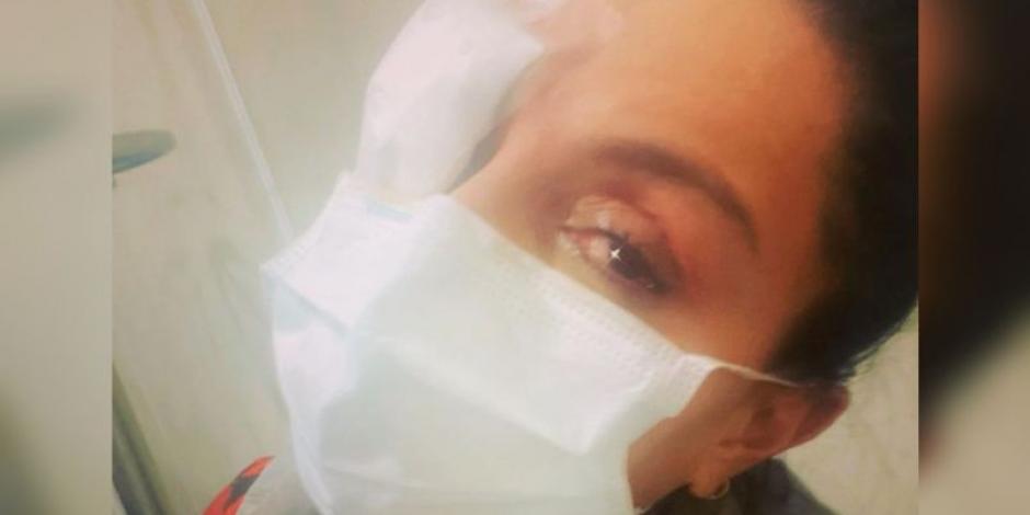 Ivonne Monterose se quema las córneas: "Ya no tenía visión" ¿Daño permanente?