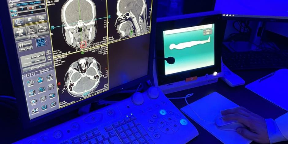 Hospital General Regional No. 12 “Lic. Benito Juárez García" recibió un nuevo equipo de tomografía con tecnología de punta.