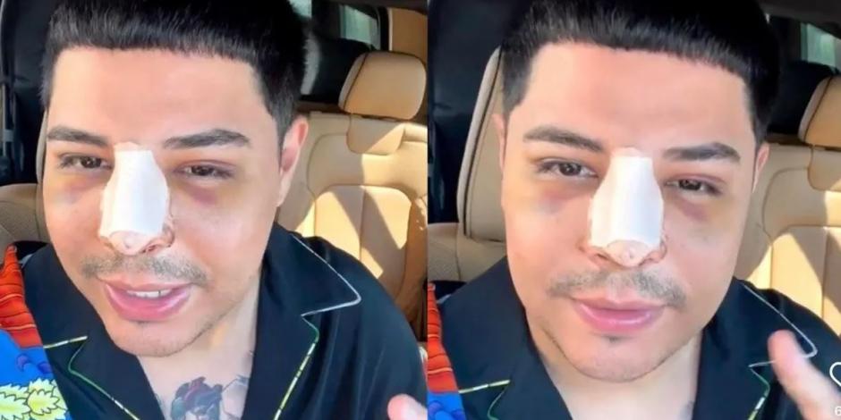 Eduin Caz de Grupo Firme reaparece tras su cirugía con la cara hinchada (VIDEO)