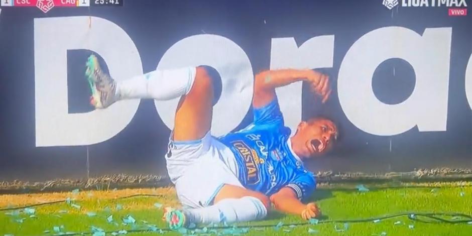 Futbolista en Perú sufre una terrible lesión.