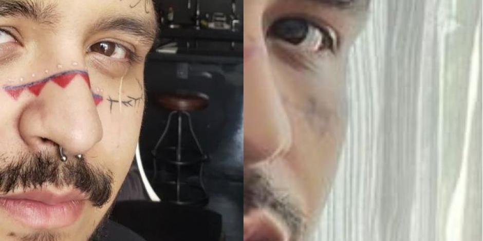 ¿Cuánto pagó Christian Nodal para borrarse los tatuajes de la cara?
