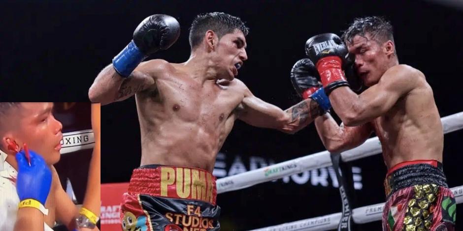 El boxeador filipino Jade Bornea terminó con la oreja rota tras su pelea con el argentino Fernando "Puma" Martínez