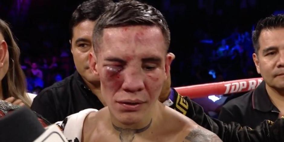 El rostro de Óscar Valdez luego de la pelea ante Emanuel 'Vaquero' Navarrete