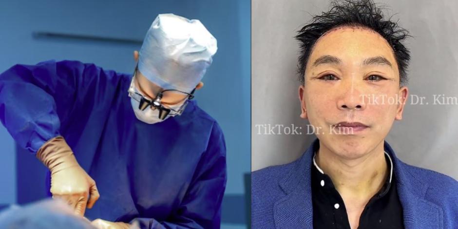 Conoce al Dr. Kim que causa terror en TikTok con sus cirugías plásticas