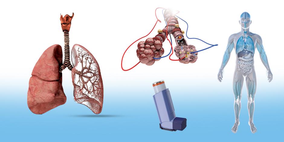 Nocaut técnico contra el asma; nuevo tratamiento promete erradicarla