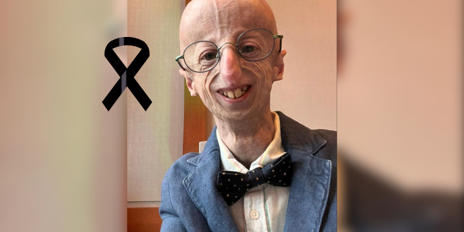 Sammy Basso dedicó su vida a visibilizar la progeria