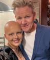 La tiktoker Maddy Baloy murió tras su lucha contra el cáncer.