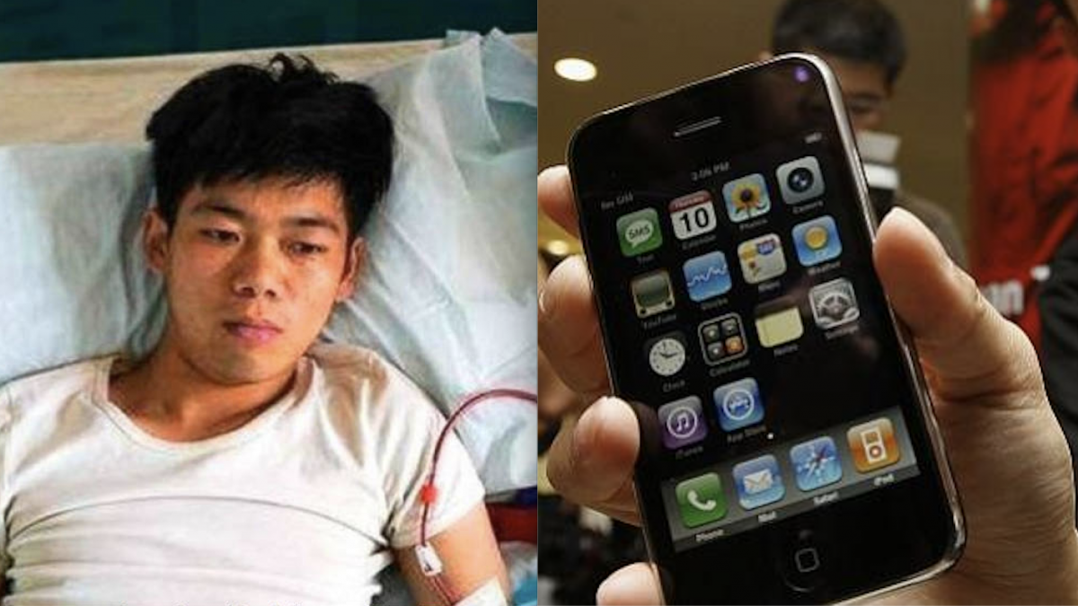 ¿Qué pasó con el joven que vendió su riñón para tener un iPhone 4?